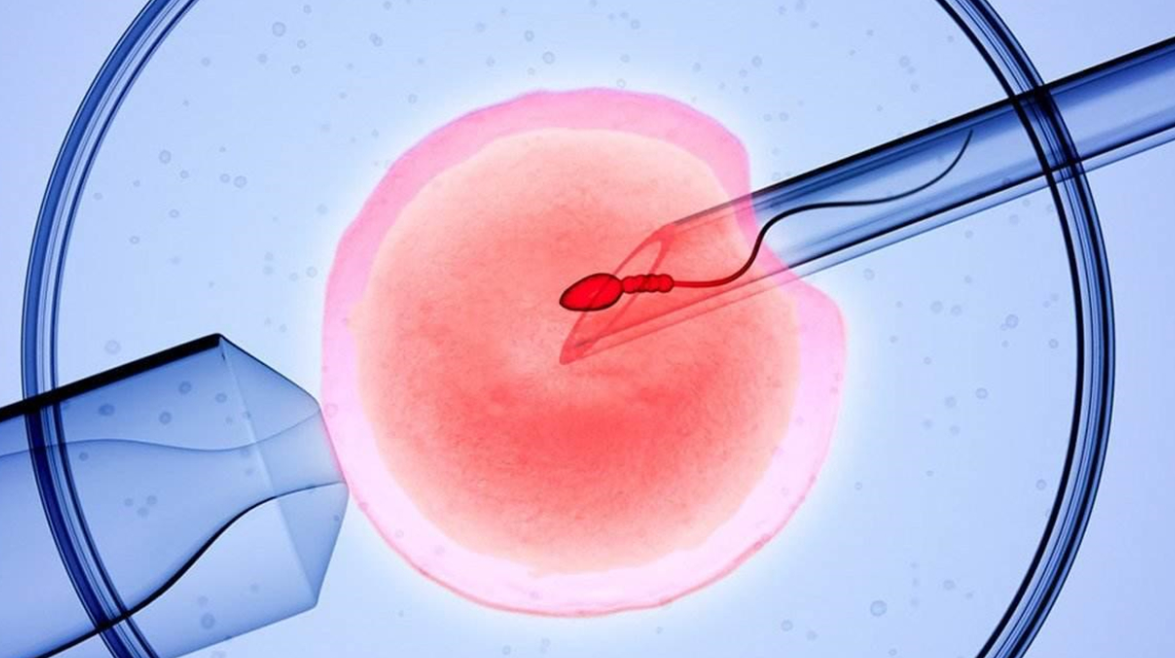 赴泰做试管婴儿，子宫环境与卵巢早衰的关系