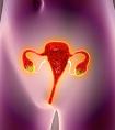 先天性子宫畸形可以做试管婴儿吗？