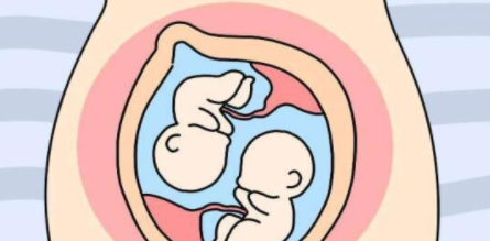 想生双胞胎促排卵方法有哪些