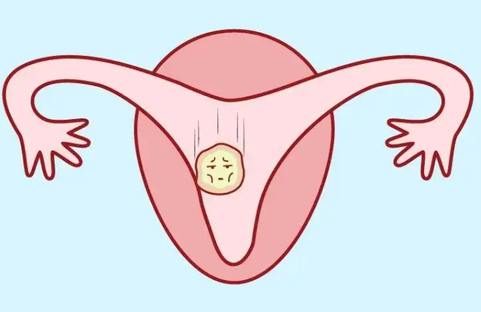 女性子宫内膜薄怎么调理增厚？吃补佳乐多久有效？