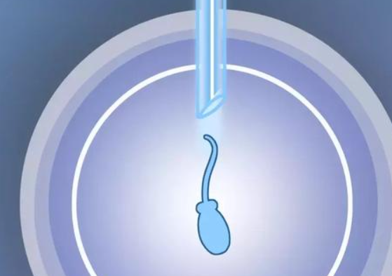 胚胎移植多长时间能测出来?不知道的不妨看下去
