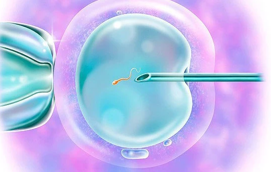 2024年新疆供卵机构排名，试管供卵辅助妊娠策略参考