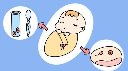 上海做试管婴儿哪家医院成功率比较高？